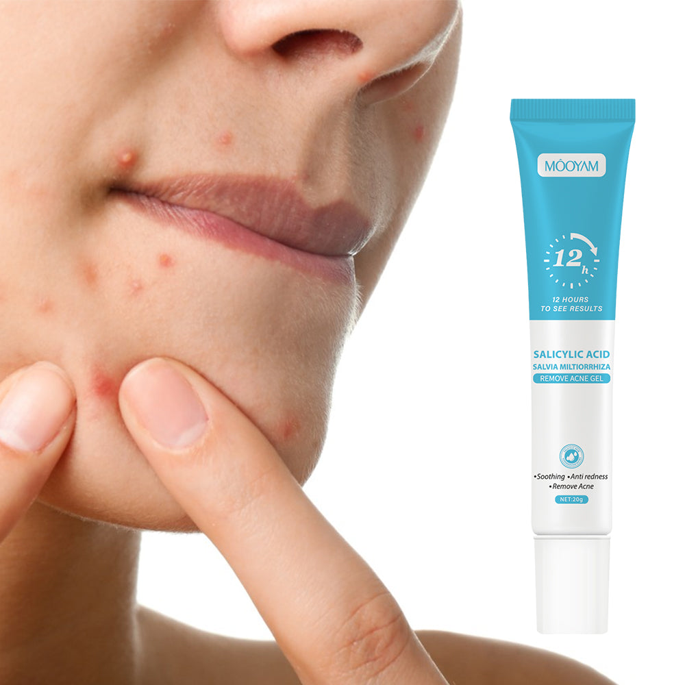 Gel Reparador Anti-Acné — Piel Lisa y Sin Manchas en 12 Horas