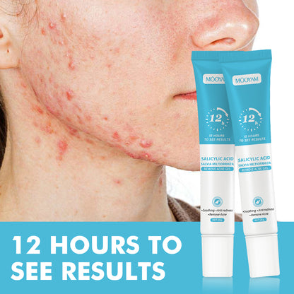 Gel Reparador Anti-Acné — Piel Lisa y Sin Manchas en 12 Horas