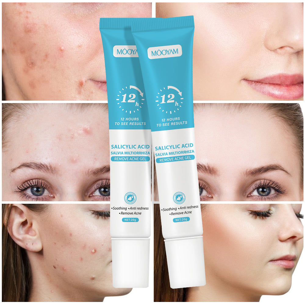 Gel Reparador Anti-Acné — Piel Lisa y Sin Manchas en 12 Horas